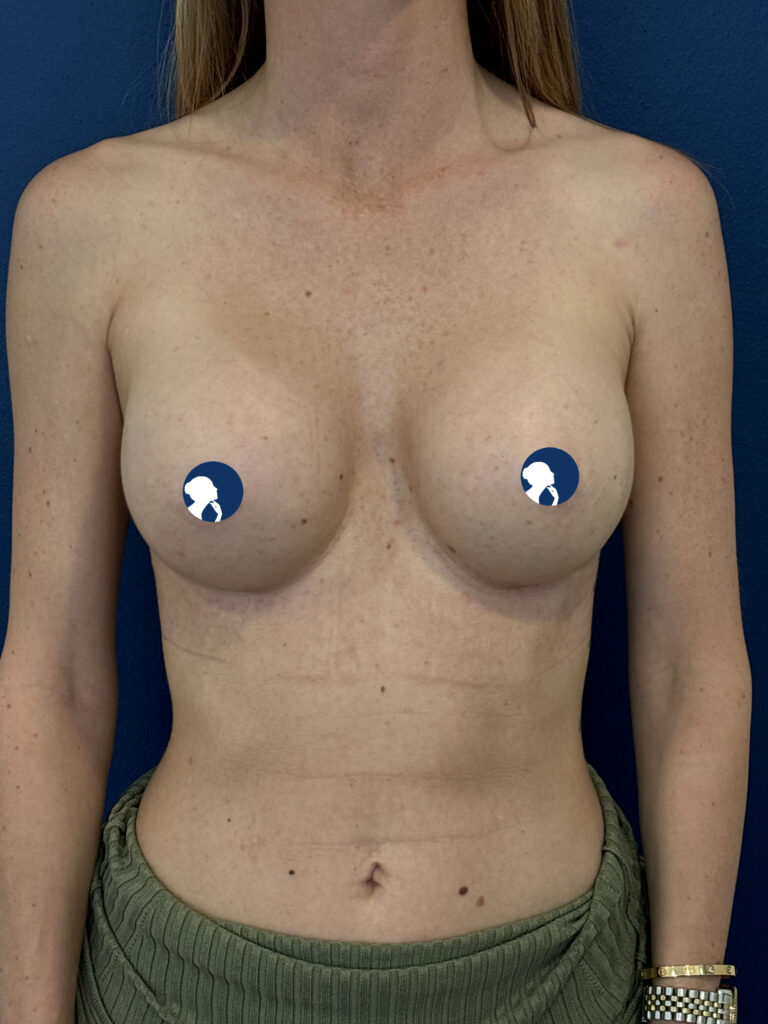pat-12-450-full-profiel-ergonomixs-5