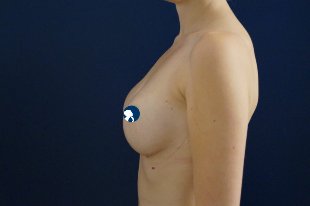 pat-5-425-full-profile-ergonomixs-4