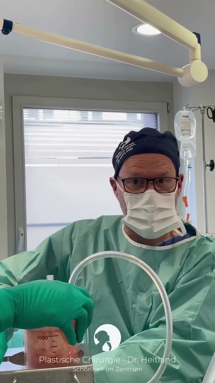 Eigenfett von Bauch zu Brust