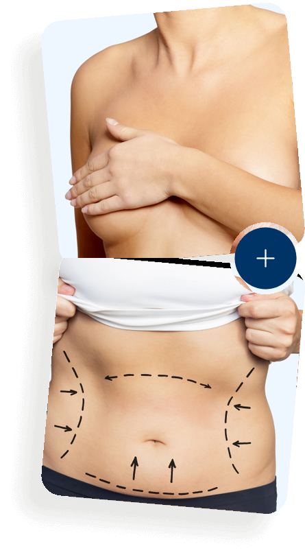 Mommy Makeover – Brust- und Bauchstraffung in einer OP