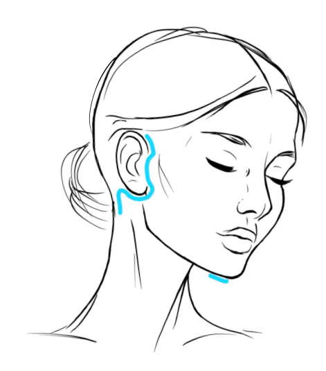Skizze: Facelifting mit kleiner Schnittführung – kurzer Schnitt am Ohr